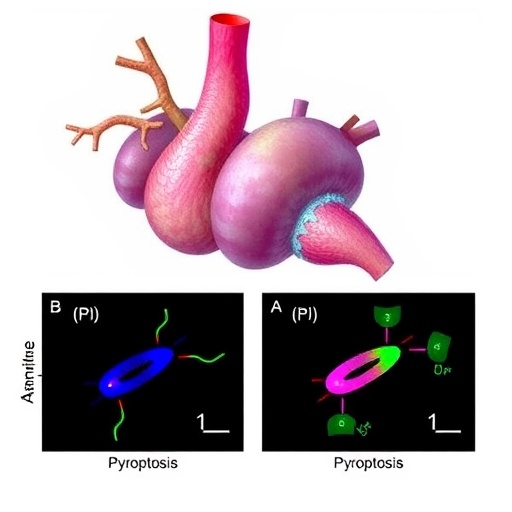 pdk4-fuels-aneurysm-via-metabolic-shift,-pyroptosis