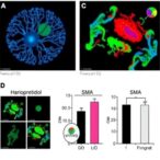 haloperidol-boosts-neuroprotection,-muscle-function-in-sma