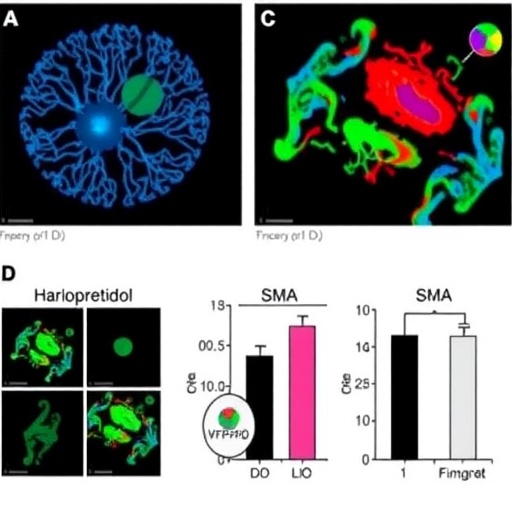 haloperidol-boosts-neuroprotection,-muscle-function-in-sma