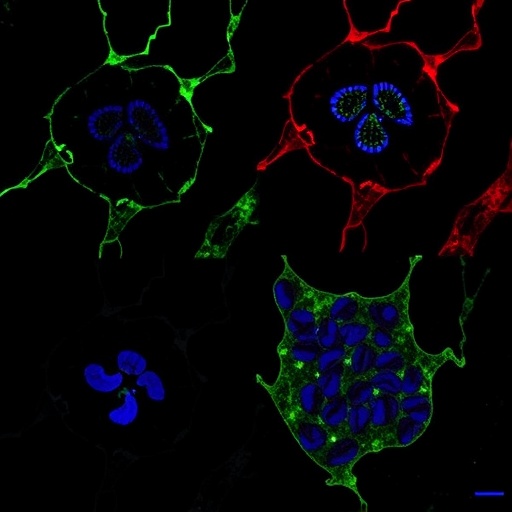nt5dc2-prevents-ferroptosis-by-stabilizing-acsl3