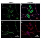 clc3-boosts-lysosomal-degradation,-driving-cisplatin-resistance