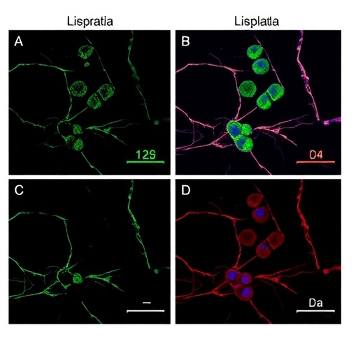 clc3-boosts-lysosomal-degradation,-driving-cisplatin-resistance