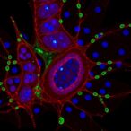 2-hexadecenal-drives-eye-neovascularization-via-s1p5