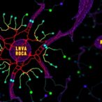 microrna-signature-predicts-localized-clear-cell-rcc