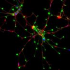 differentiated-sh-sy5y-cells-show-neuronal-traits,-immature-synapses