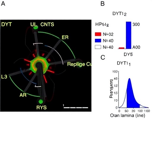 dysregulated-lamin-b1-thickens-nuclear-lamina-in-dyt1