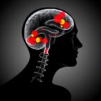 psmf1-variants-cause-parkinsonism-to-perinatal-death