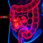 notch-signaling-drives-colorectal-cancer-metastasis-via-smads