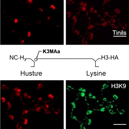 kdm3a-oxidizes-acetyl-lysine-on-histone-h3k9