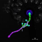 amyloid-β-impairs-glymphatic-flow-via-astrocyte-cholesterol