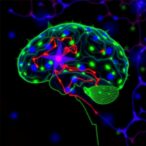 brain-cell-study-uncovers-microglia-role-in-msa