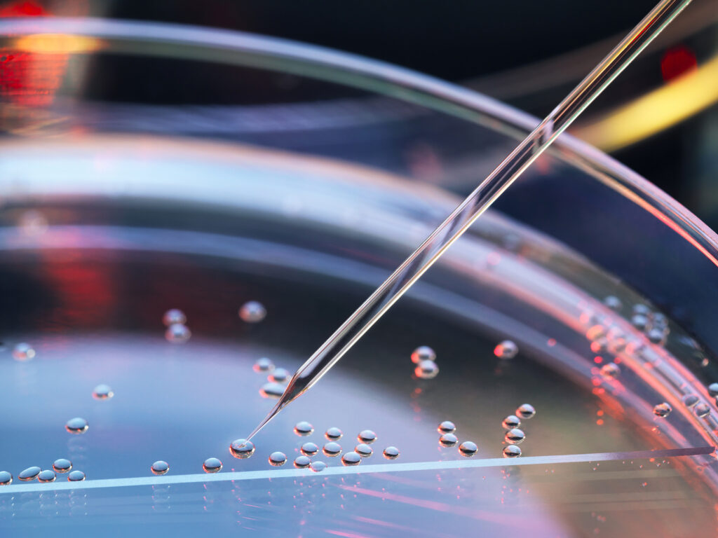ipsc-based-manufacture-vs.-autologous-model-production-costs-examined-via-financial-analysis