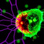 pink-1-mutation-sparks-gut,-brain-cell-damage