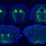 brain-circuits-underlying-placebo-pain-relief-identified-in-mice