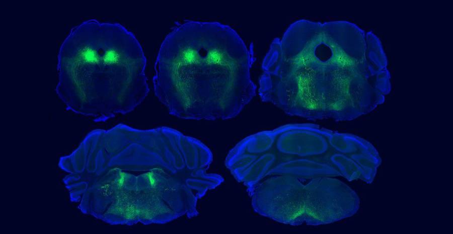brain-circuits-underlying-placebo-pain-relief-identified-in-mice