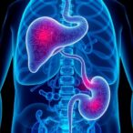 nat10-drives-gallbladder-cancer-via-cholesterol-metabolism