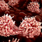 stem-cell-editing-programs-the-immune-system-to-make-own-therapeutic-proteins