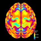 brain-atlas-maps-region-specific-responses-to-neurotoxocariasis