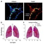 hdac11-drives-lung-fibrosis-via-mitophagy-inhibition