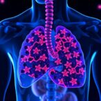 pd-l1-cps-in-gastroesophageal-cancer:-care-vs.-trials