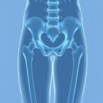comorbidities-shape-hip-fracture-surgery-outcomes