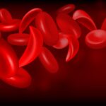 novo-readies-scd-drug-from-$1.1b-forma-buyout-for-approval-push-after-phase-3-win