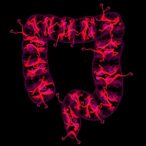 jak1-inhibitors-fight-colitis-via-nlrp3-blockade