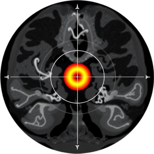 assessing-target-irregularity-as-a-key-factor-in-gamma-knife-treatment-planning