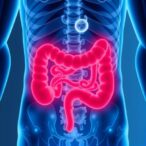 rising-rates-of-colorectal-cancer-among-swiss-adults-under-50-highlight-emerging-health-concern