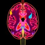 invasive-neurally-adjusted-ventilation-feasibility-in-severe-cdh