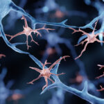 alzheimer’s-linked-to-cancer-mutations-in-brain-immune-cells