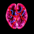 brain-blood-flow-in-teens-after-infant-heart-surgery