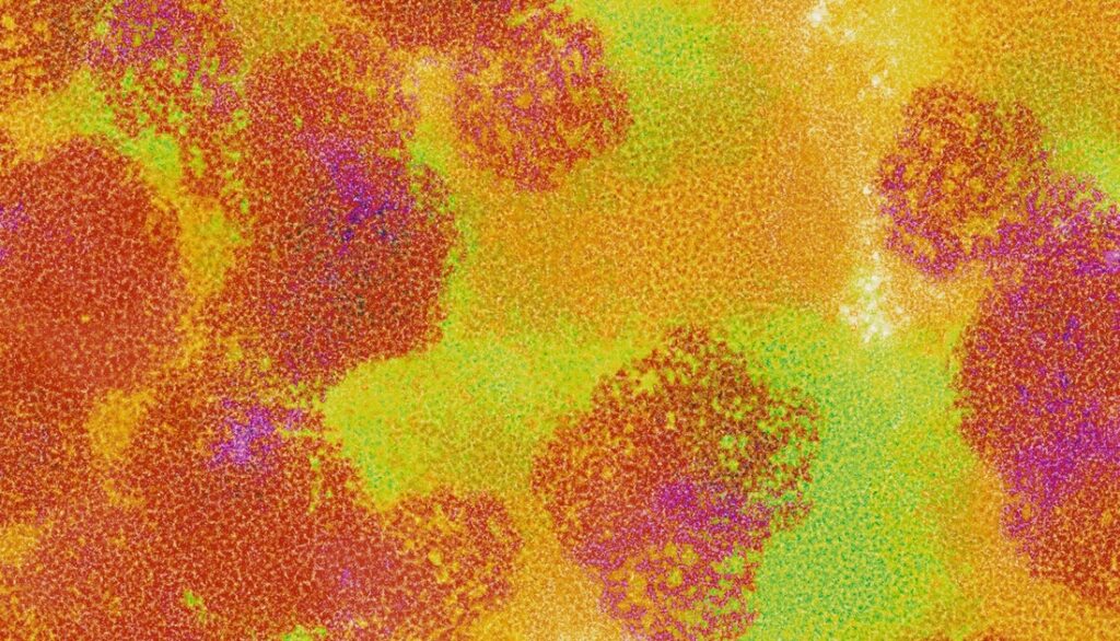 overcoming-the-vlp-purification-bottleneck