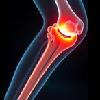 predicting-hidden-blood-loss-in-elderly-femur-fractures