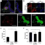 icaritin-reverses-stat3-driven-egfr-tki-resistance