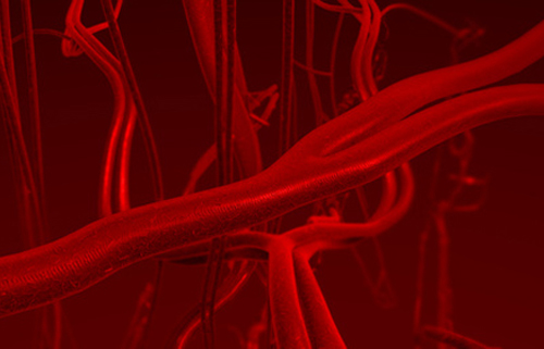 cellular-mechanisms-behind-diabetes-derived-vascular-disease-unveiled