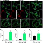 flag-based-regimen-yields-robust-results-in-acute-myeloid-leukemia-subtype