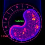 new-scoring-tool-reveals-how-radiation-reprograms-the-pancreatic-tumor-microenvironment