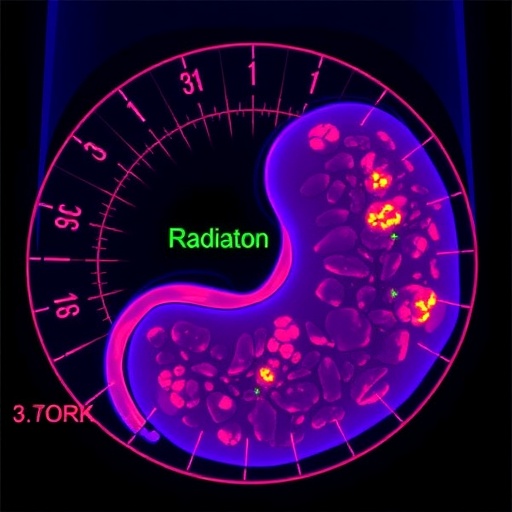new-scoring-tool-reveals-how-radiation-reprograms-the-pancreatic-tumor-microenvironment