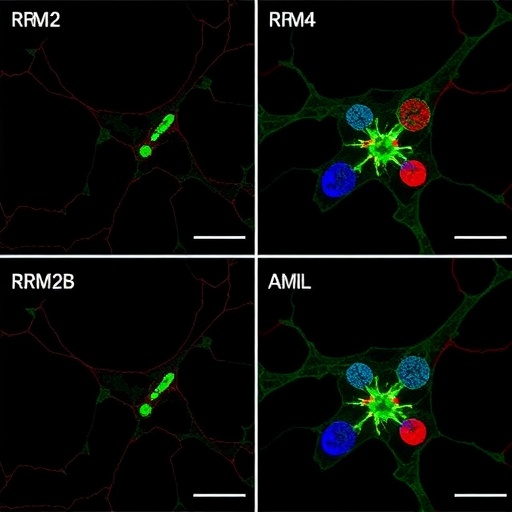 rrm2-and-rrm2b-in-aml-stress-response,-differentiation