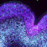 single-cell-atlas-of-the-prenatal-brain-reveals-how-down-syndrome-reshapes-development