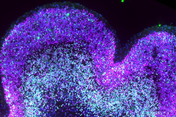 single-cell-atlas-of-the-prenatal-brain-reveals-how-down-syndrome-reshapes-development