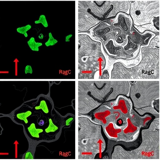 ragc-detects-β-hydroxybutyrate-levels-to-inhibit-mtorc1-activity-and-tumor-progression