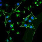 aurka/phb2-signaling-fuels-resistance-to-kras-g12c-inhibitors