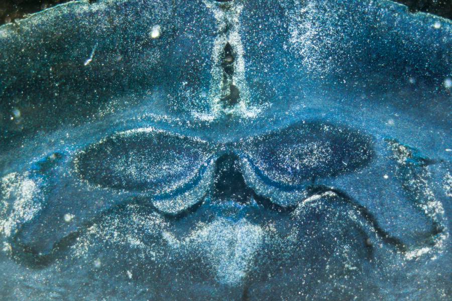 abdominal-contractions-may-drive-brain-fluid-flow,-aiding-in-neural-waste-clearance