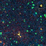 anticancer-strategy-targets-defense-mechanism-in-senescent-cells