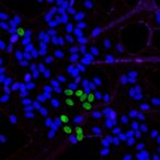 epithelial-slc39a1-shields-male-mice-from-lung-injury