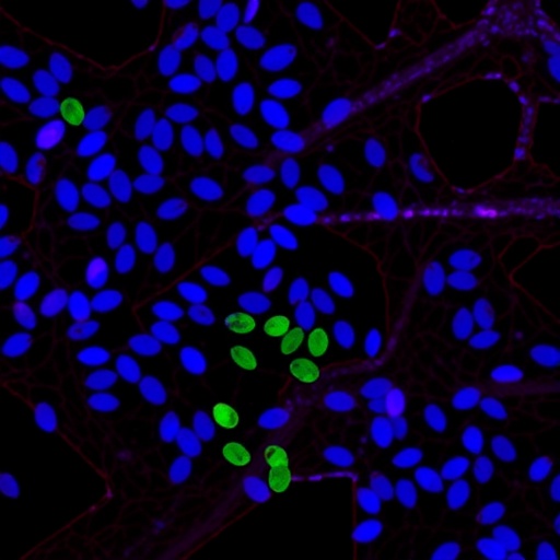 epithelial-slc39a1-shields-male-mice-from-lung-injury