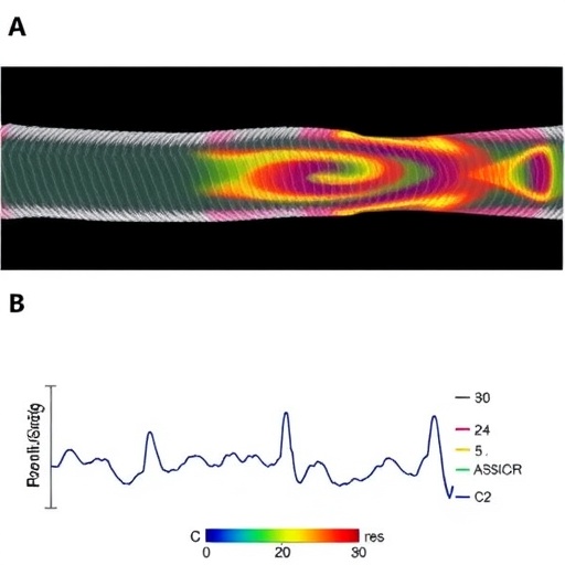 prickle1-controls-neural-tube-shape-independently