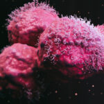 prostate-cancer-therapy-targets-disordered-region-of-androgen-receptor